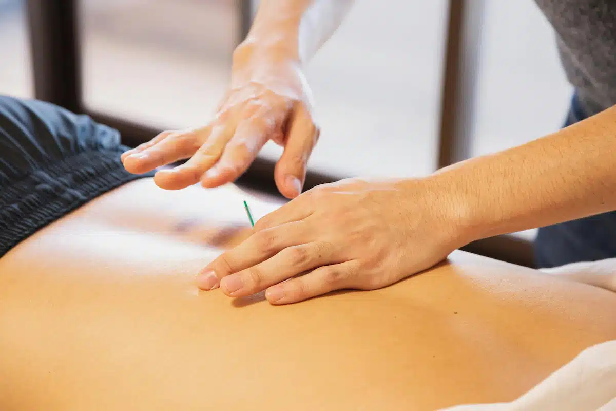 Therapist pricking skin with needles during treatment procedure